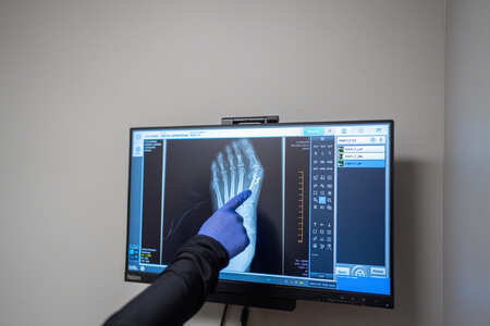 sports medicine and foot/ankle pain relief in Danbury, Southbury, and Naugatuck CT